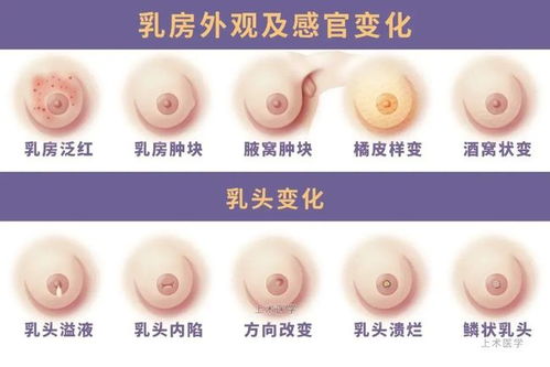 薄荷贴式植入术 VS 填充物支架术 VS 自主瓣切除术