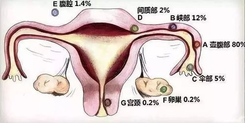一、先来一段情绪爆炸的开场白
