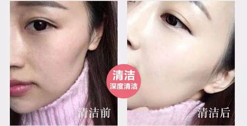 第一步——先停下手中的全部“刺激”