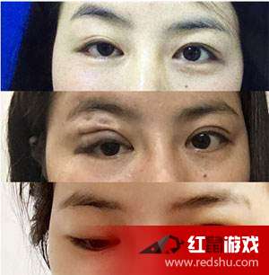 择吉原则——您确定要听我的吗？