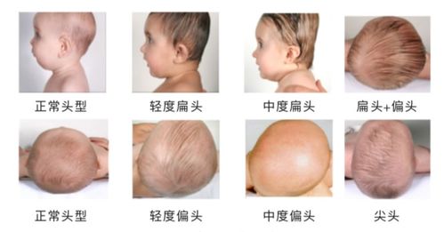 面色发青？2026年要小心了！