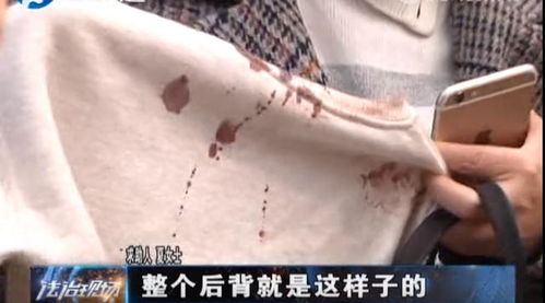 本命年见血有什么特别的说法或讲究吗？