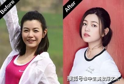 女性M型发际线适合剪哪种八字刘海发型？