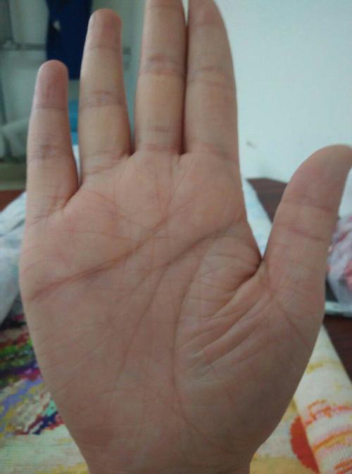 手掌乱纹多预示着什么？掌纹乱有什么化解办法？