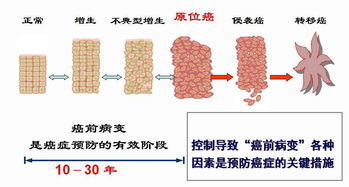病变吉凶是否意味着癌症的预后好坏？