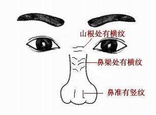 印堂八字纹命运如何？智慧线印堂上最佳纹路是哪三种？
