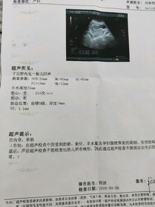 生男生女？看八字不如看B超！
