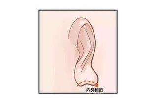耳垂大的人都是傻白甜？性格分析大揭秘