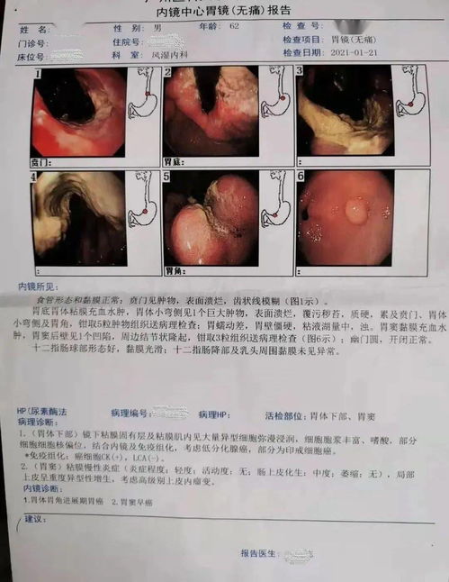 (三) 实际案例分享 —— “从‘小豆芽’到‘闪电侠’ 的惊险历程 ”