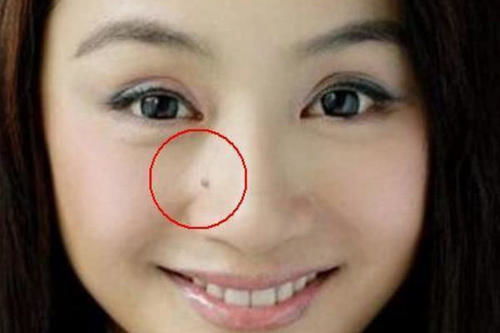 天啊！你鼻子旁边的小黑点竟然是财富杀手？！