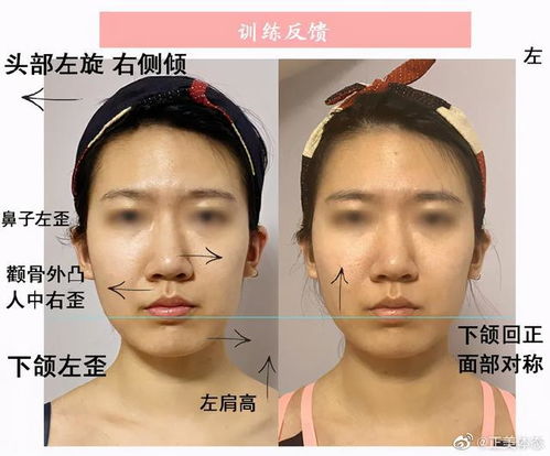 嘴部歪斜对家居风水有影响吗？