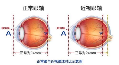 眼球凸出的风水说法,眼球凸的人性格