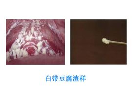 自我诊断指南（仅供参考）