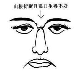 山根断裂怎么办？