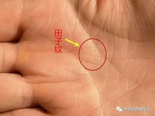 什么是田字纹?