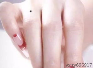 苦情痣与女人的婚姻