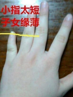 手相小拇指看肾虚，如何判断肾功能好坏？