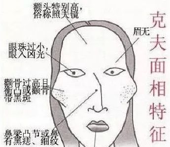 眉毛下面的黄金地段