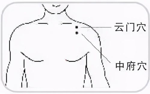 别着急！还有内关穴！