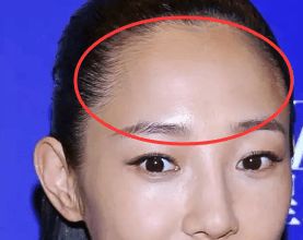 额头窄扁头型适合哪种面相？