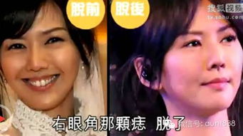 娱乐圈里的痣美人