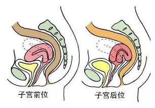 较小技巧：把温度设成“暖心”模式