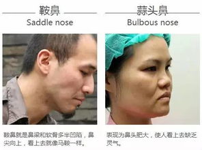男人的鼻子：命运的开关还是颜值的绊脚石？