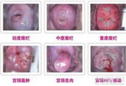 1.1 症状与误区