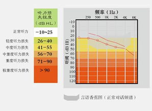 A）市场价格区间明确划分（预算攻略）