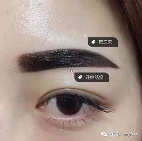 眉毛突然大量断裂是什么原因导致的？