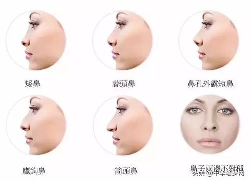 鼻子歪的人命运和性格是否都特别不幸怪异？