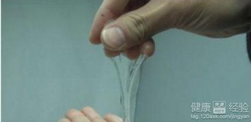 白带凝胶状到底是怎么回事？——一个乱七八糟的“命名”探险