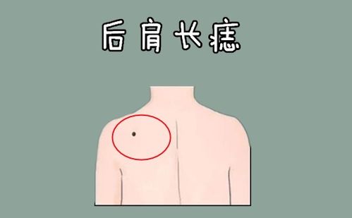 鼻尖长痣？2026年暴富预警！看完这篇你会尖叫