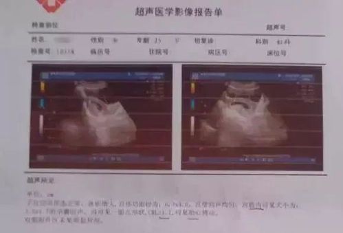 4. 怎样提升测算准确性——科学研究与艺术创作并存!🌟✨🔬🎨🖌