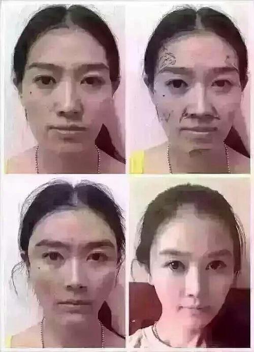 嘴边有两条八字形线条凹陷，这是怎么回事呢？