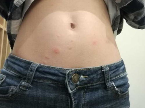 血迹斑斑：星盘揭秘与流年不利