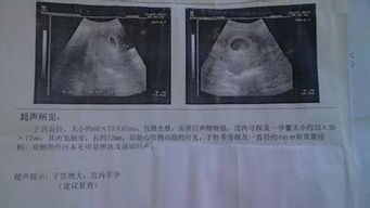 三、 怀孕月份×父亲年龄÷母亲年龄——再一次的胡编乱造