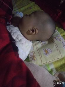 后脑勺枕骨突逐渐增大，这是正常的生理现象吗？如何应对？