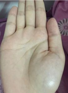 贵人纹长得像WiFi信号？