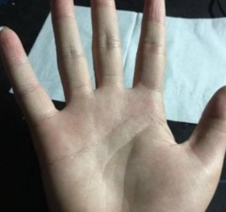 手腕上的掌纹是为什么会有呢？