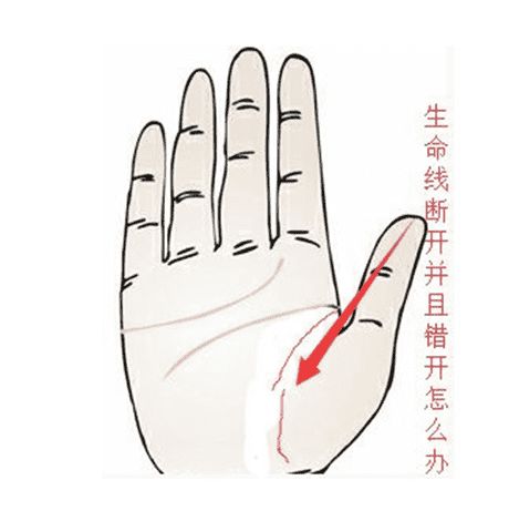 生命线纠缠型
