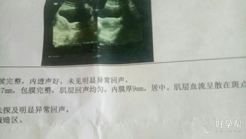 1. 更多囊卵巢综合征（PCOS）——最可怕的“激素吸血鬼”！