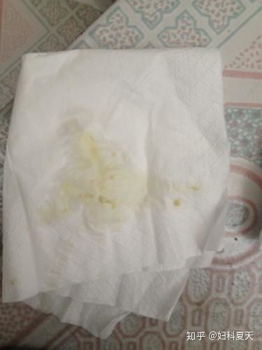 医治方案对比表格