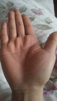 女性手相大拇指黑痣与掌心痣有何关联？