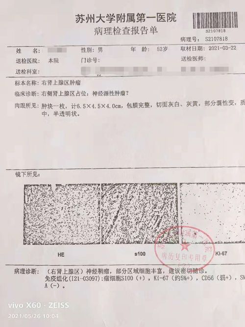 真人真事！不看黄历出院的惨痛教训