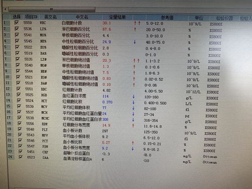 1、先从音韵说起——甜蜜还是尖锐？