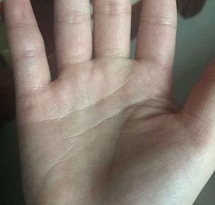 七、 手腕细的十字印记之谜