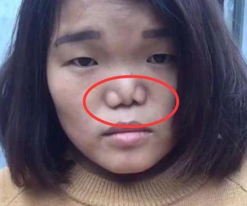 动鼻子对风水有影响吗？女人这样Zuo会有什么后果？