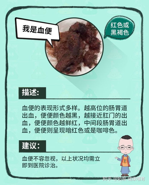 梦见拉屎或大便预示着什么吉凶祸福？