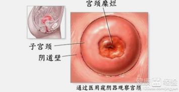 生孩子这事儿和它有啥关系？具体能较差到哪些程度？